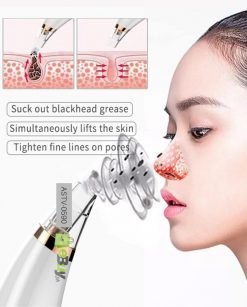 Acne Pore & Blackhead Remover Rechargeable Best Price In Pakistan