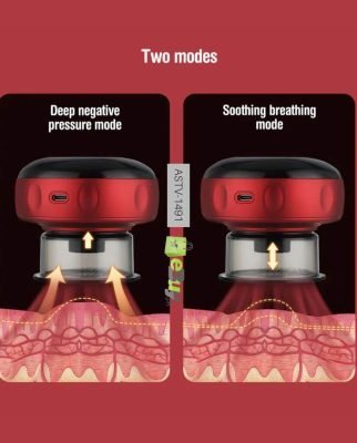 Electric Cupping Massage Instrument In Pakistan