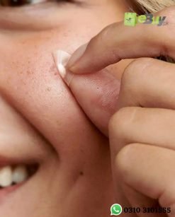 Hydrocolloid Acne Pimple Absorbing Sticker At Best Price In Pakistan