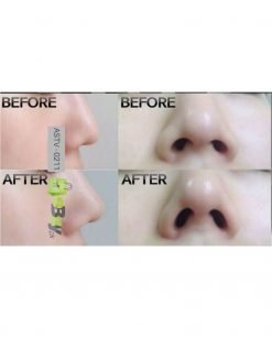 Nose Clipper - Nose Shaping Beauty Kit Online in Paksitan