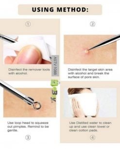 Pimple And Blackhead Remover Online Price In Pakistan